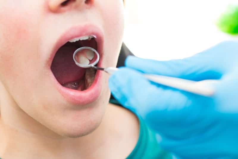 Dentist using a dental mirror to examine a patient's teeth during a routine oral health checkup.
